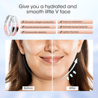 HailiCare V Face Face-lifting Instrument Facial Slimming Massager Photon Rejuvenation TENS Microcurrent Multifunctional Beauty Instrument Facial Lift Firming Skin Shaping Face Rejuvenation HailiCare Health & Beauty