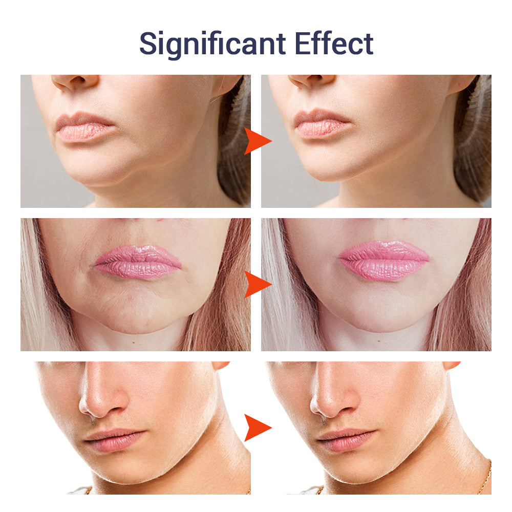 V Face Facial Massage Cream Tighten Contour Firming Lift Chin Moisturizing Skin Anti-Aging Improve Sagging Skin Facial Skin Care 30g HailiCare