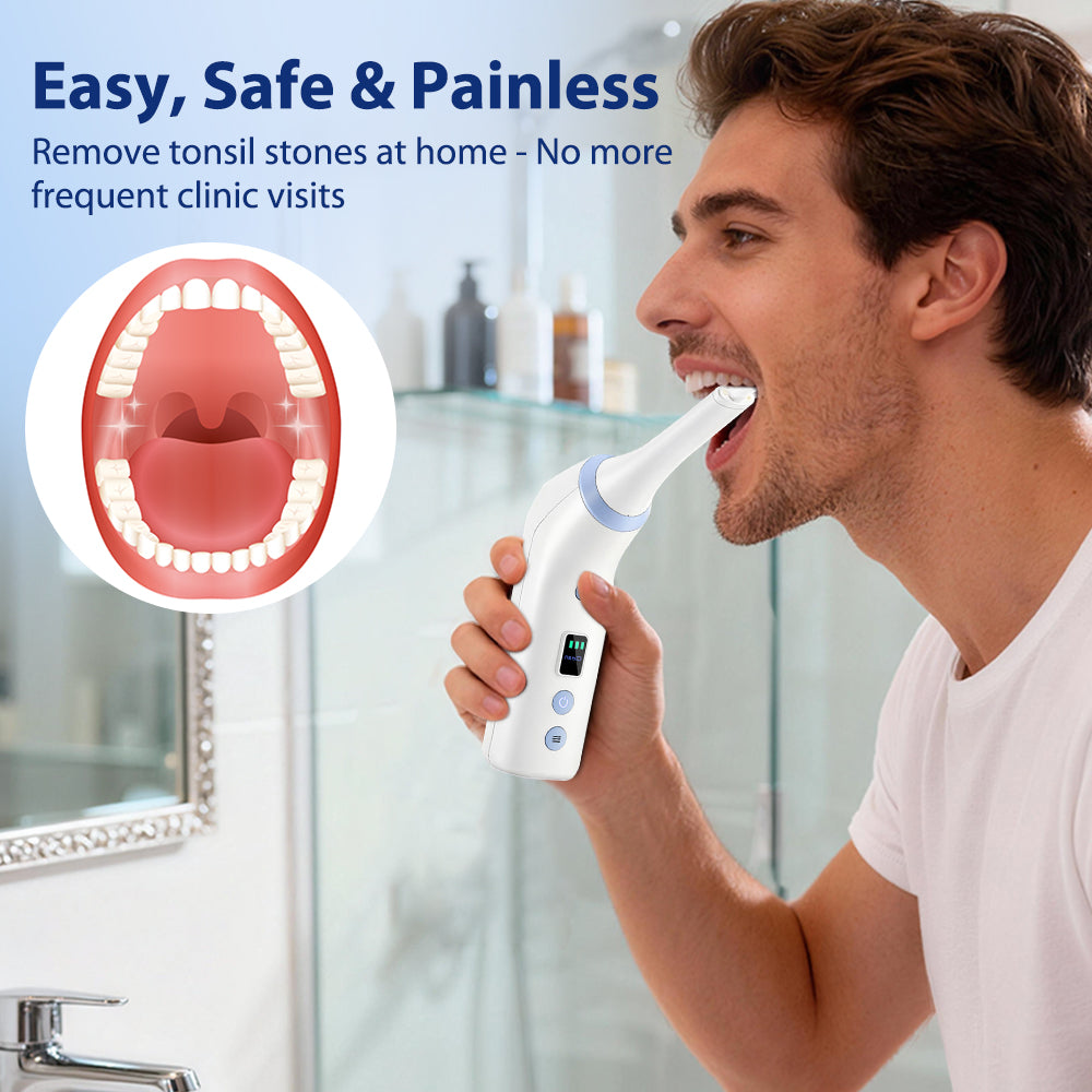 Electronic Tonsil Stone Remover Vacuum,Cordless Tonsil Stone Removal Kit Tool with 75KPA Suction & LED Light,Upgraded Tonsil Cleaner,5X Magnifying Mirror,Fight Bad Breath, Mouth Cleaning Oral Care BearCris