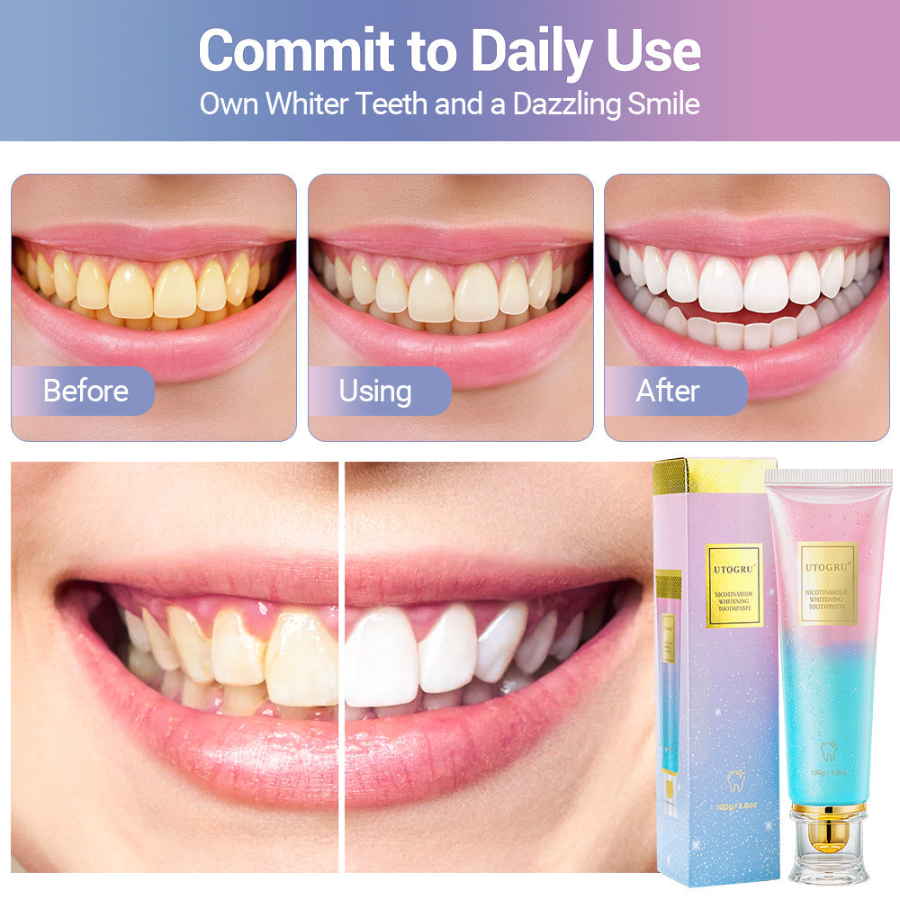 Niacinamide Whitening Toothpaste, Niacinamide Intensive Whitening Toothpaste with Natural Gentle Care Deep Stain Removal Mint Flavor Toothpaste Improves Gum Health Fresh Breath 1 PCS HailiCare