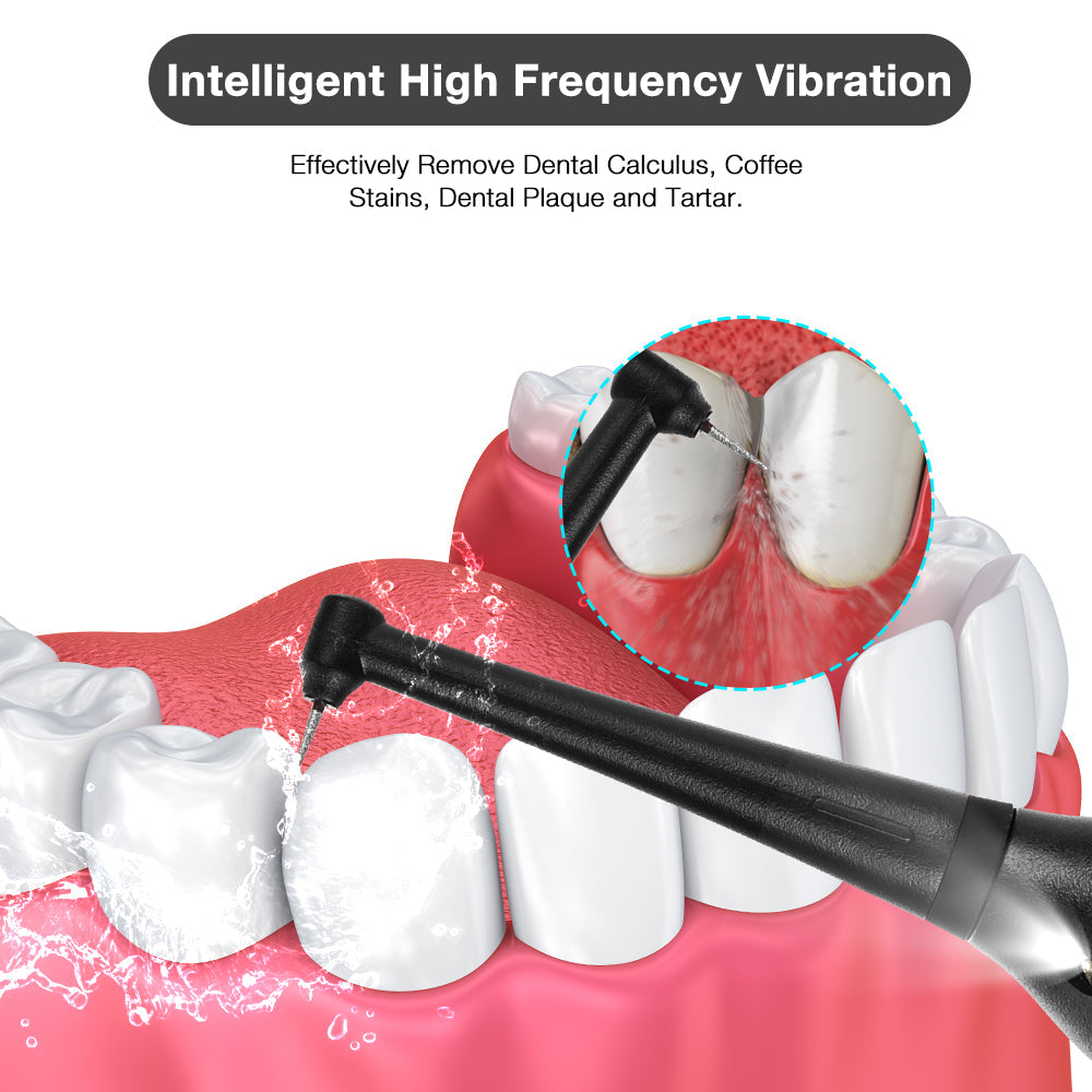 BearCris Electric Ultrasonic Dental Calculus Remover, Portable Teeth Stains Cleaning Tools Kit BearCris